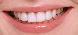 白い歯が与える印象